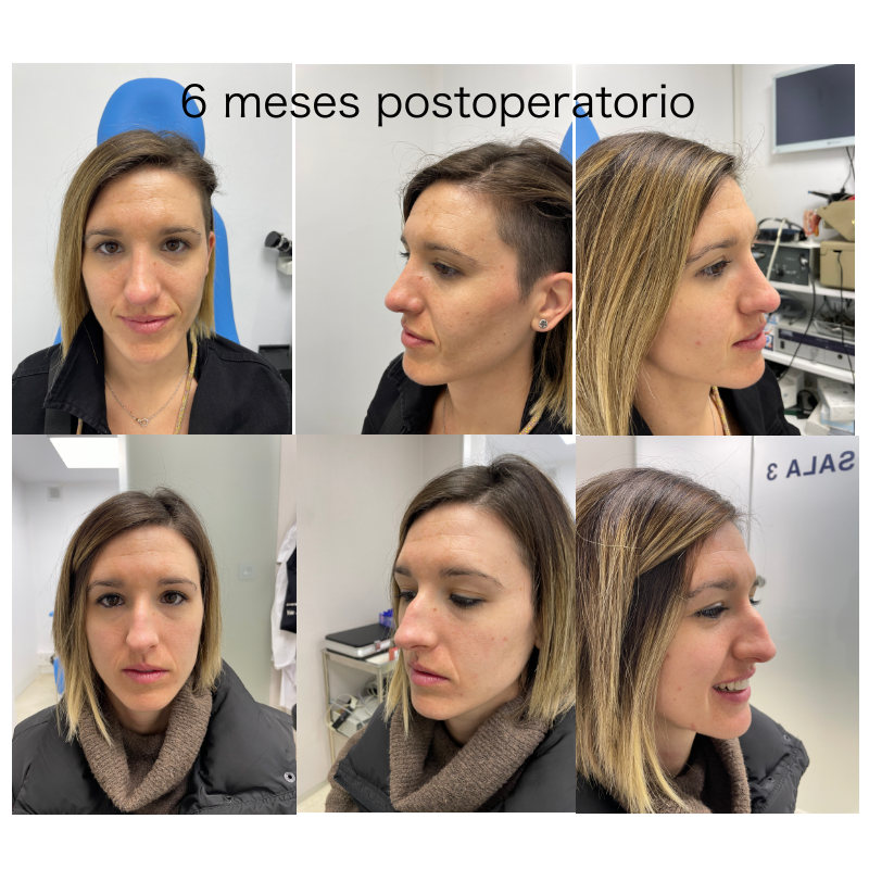 Resultado 1